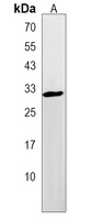 Anti-TMEM66 Antibody