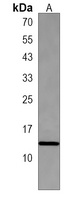 Anti-HIST1H2BJ Antibody