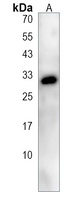 Anti-CES1P1 Antibody