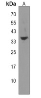 Anti-B3GNT4 Antibody