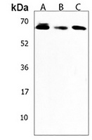 Anti-AMY2B Antibody