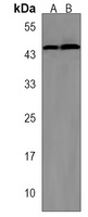 Anti-MCH Receptor 1 Antibody