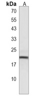Anti-CPLX3 Antibody