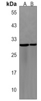Anti-PRRG3 Antibody