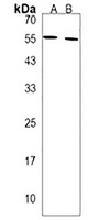 Anti-SPATC1 Antibody