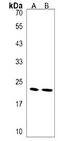 Anti-GTSF1 Antibody