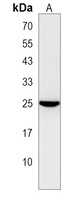 Anti-NUDT8 Antibody