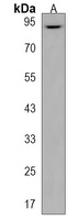 Anti-ZBTB41 Antibody