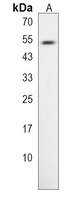 Anti-TLDC1 Antibody