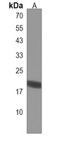 Anti-AP3S1 Antibody