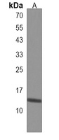 Anti-ISCA2 Antibody