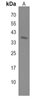 Anti-Neuroserpin Antibody