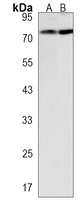 Anti-NSUN7 Antibody