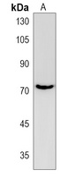 Anti-ZNF595 Antibody