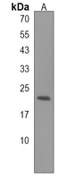 Anti-NOS1AP Antibody