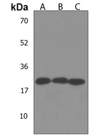 Anti-PEMT Antibody