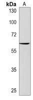 Anti-MOCS1 Antibody