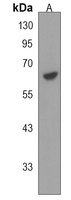 Anti-RADIL Antibody