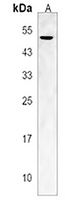 Anti-GCNT2 Antibody