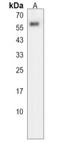 Anti-GALNT4 Antibody