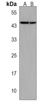 Anti-TFB2M Antibody