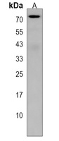 Anti-RFT1 Antibody