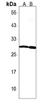 Anti-LAPTM5 Antibody