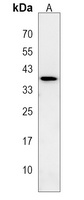 Anti-LGALS9B Antibody