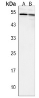 Anti-SCARA5 Antibody