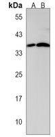 Anti-CTDSPL Antibody