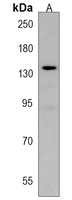 Anti-POTEE Antibody