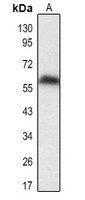 Anti-DUSP8 Antibody