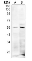 Anti-MLKL (Phospho-S345) Antibody