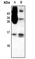 Anti-CCL1 Antibody (BSA and Azide free)