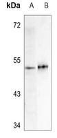 Anti-AAMP Antibody