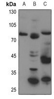 Anti-ABCB7 Antibody