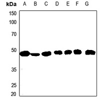 Anti-ACAT1 Antibody