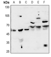 ACHE antibody