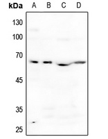 ACVR1B antibody