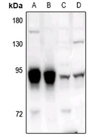 Anti-ADAR2 Antibody