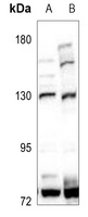 Anti-Adenylate Cyclase 1 Antibody