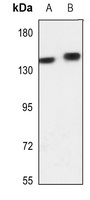 Anti-Adenylate Cyclase 5/6 Antibody