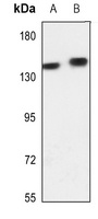 ADCY5 antibody