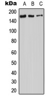 Anti-Adenylate Cyclase 9 Antibody