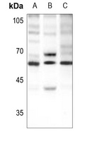Anti-Beta-2 Adrenergic Receptor (Phospho-S346) Antibody