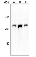 ACAN antibody