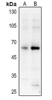 Anti-AKT (Phospho-S473) Antibody