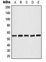 Anti-AKT (Phospho-T308) Antibody