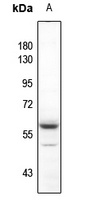 Anti-AKT (Phospho-Y315) Antibody