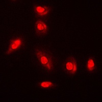 AKT (Phospho-Y315) Rabbit Polyclonal Antibody